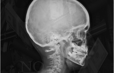 [Single] Nado – No Brain @Nado_Savage